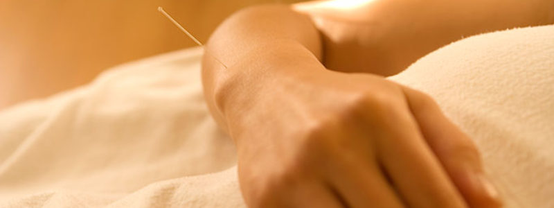 acupuntura na gestação é seguro?